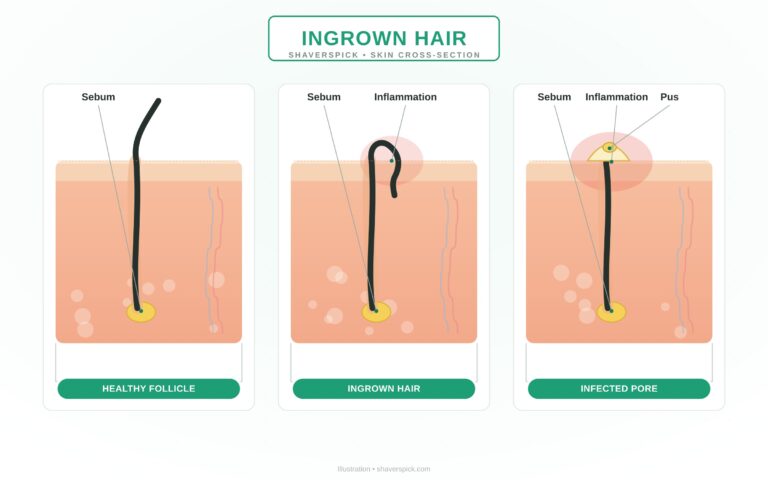 in grown hair section