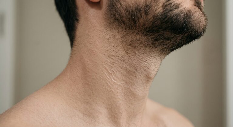 Close-up of the neck area, a common spot for ingrown hairs after shaving